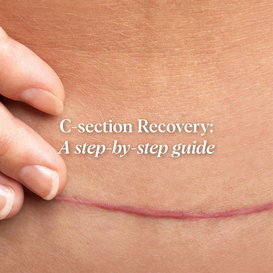 C-section Scar Recovery: A Step-by-Step Guide