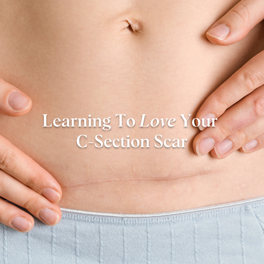 How To Massage Your C-section Scar: Learning To Love Your Stomach