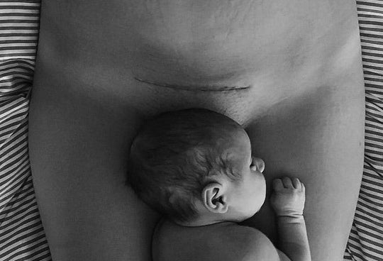 POST C-SECTION SCAR MASSAGE_Nessa Organics_Photo_@happymermaid