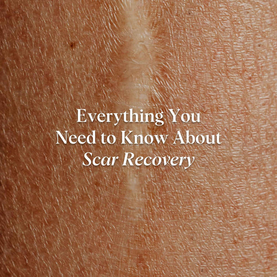 everything you need to know about scar recovery